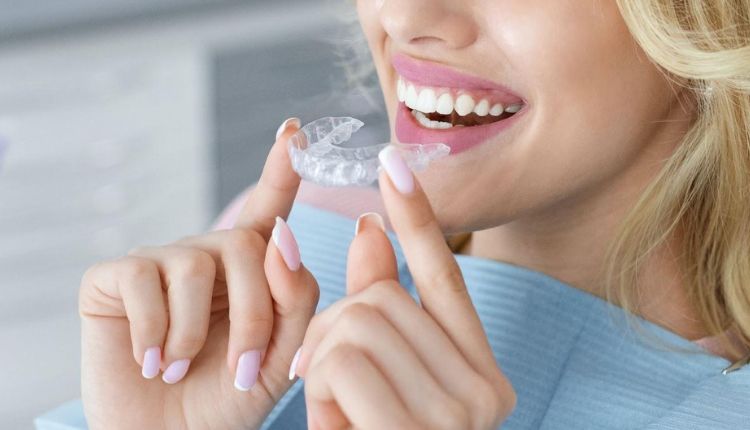 Byte Clear Aligners Review