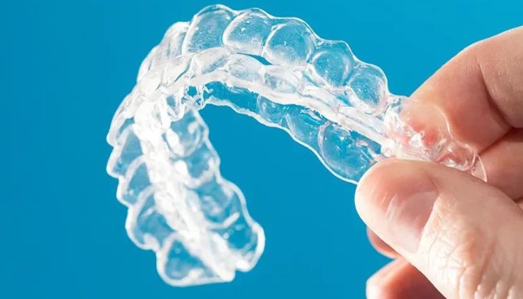 Byte Vs Smile Direct Club