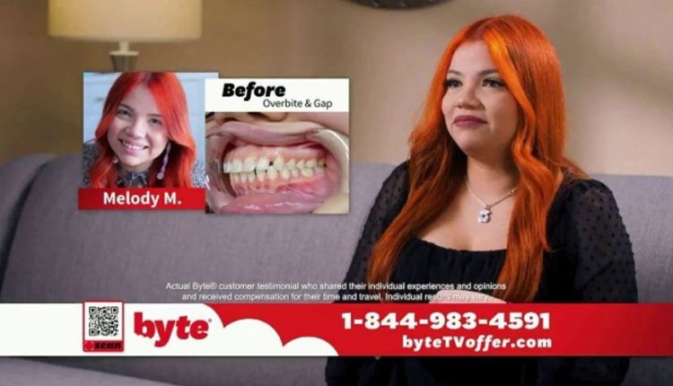 Byte Before And After Overbite